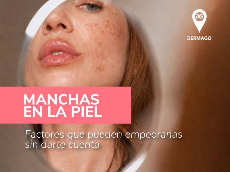 manchas en la piel