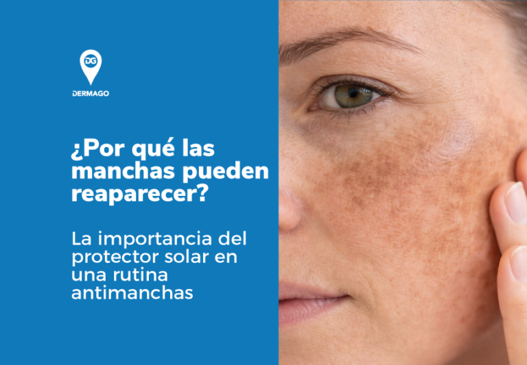 Rutina antimanchas dermago
