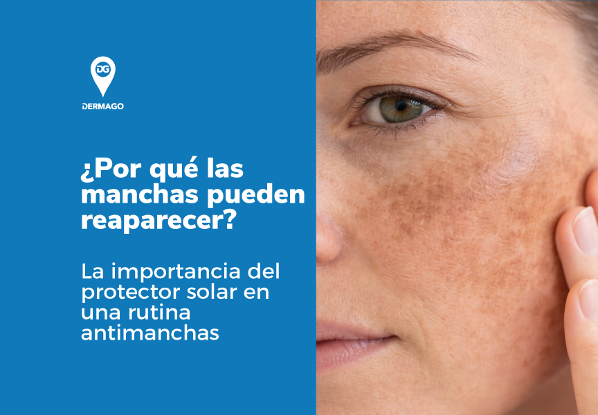 Rutina antimanchas dermago