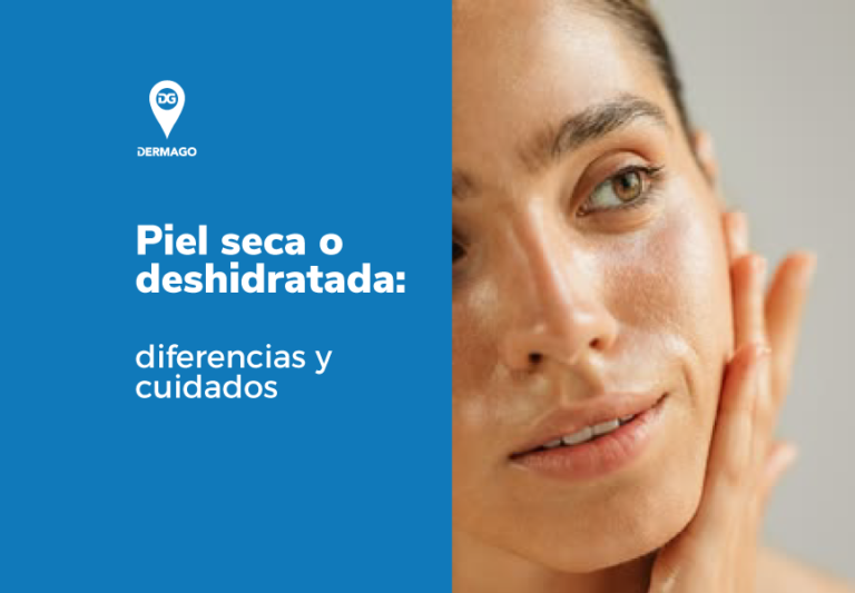 piel seca o deshidratada