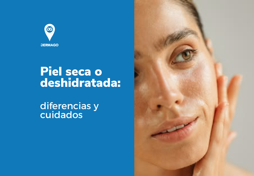 piel seca o deshidratada